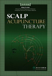 (image for) Scalp Acupunctrue Wall Chart - Click Image to Close