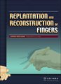 (image for) Replantation and Reconstruction of Fingers