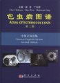 (image for) Atlas of Echinococcosis (Second Edition)