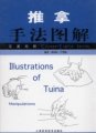 (image for) Illustrations of Tuina Manipulations